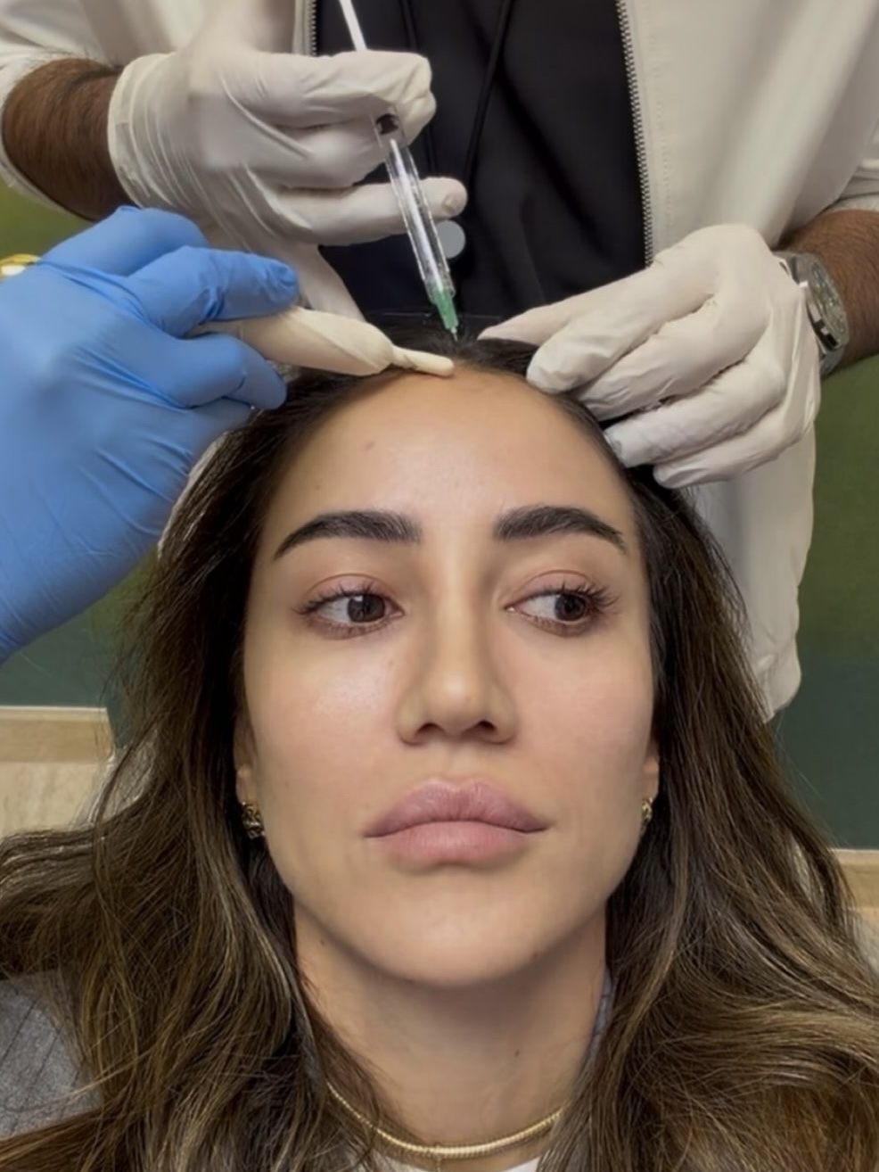 Best-Bridal-Beauty Treatments