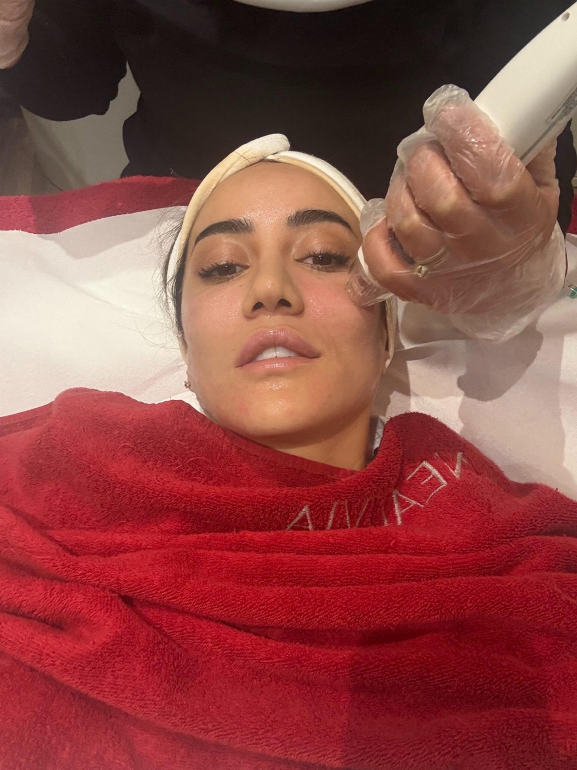 Best-Bridal-Beauty Treatments